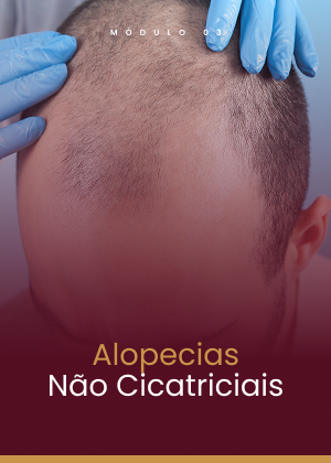 Módulo 03